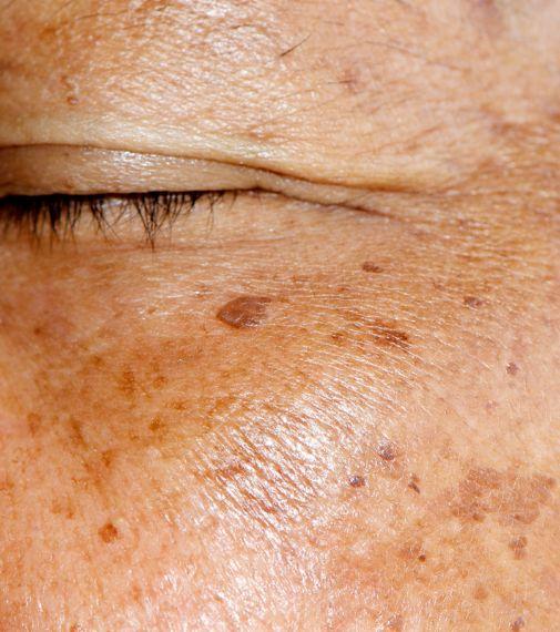 EZT VÁRHATOD A SILK HIDRATÁLÓ KRÉMTŐL SZÁRAZ BŐRRE: