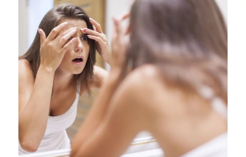 A pattanás utáni foltok eltüntetése krémmel