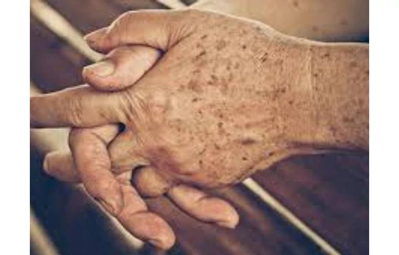 A pigmentfolt kialakulásának okai